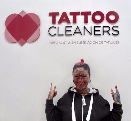 La mujer más tatuada de Europa elige Tattoo Cleaners para eliminar los tatuajes de su cara