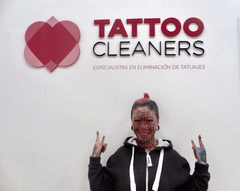 La mujer más tatuada de Europa elige Tattoo Cleaners para eliminar los tatuajes de su cara