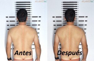 P1 - Antes y Después