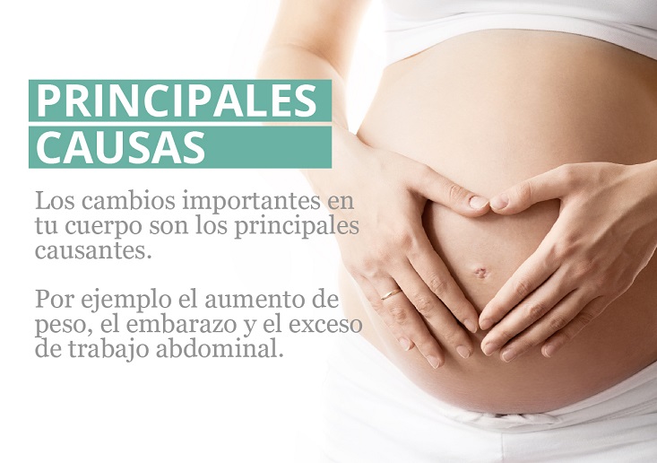 Recupera tu abdomen tras el parto