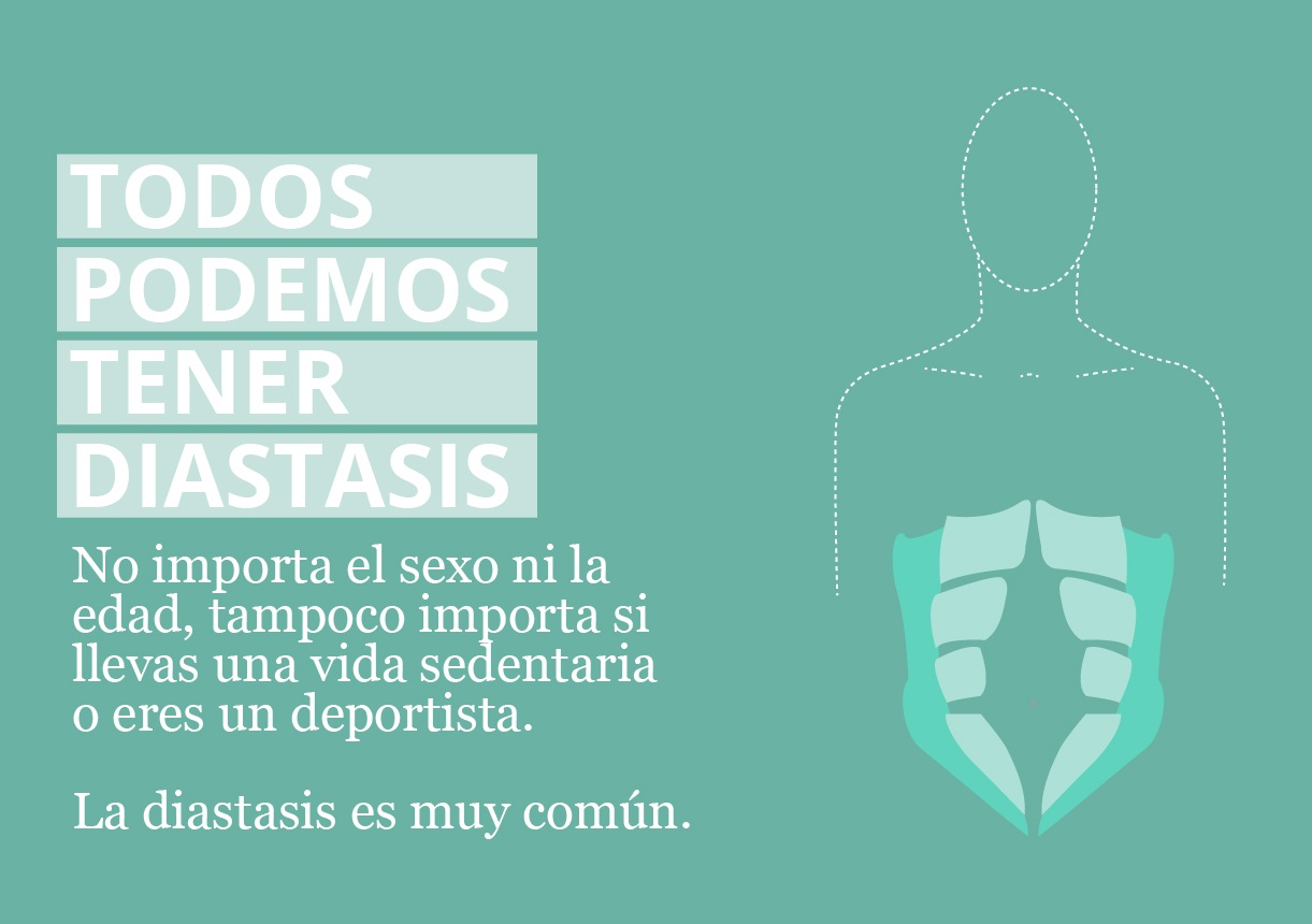 Diástasis Abdominal la gran desconocida después del parto