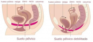 suelo-pelvico-vs-suelo-pelvico-debilitado